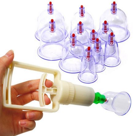 Набор Cupping Transparent